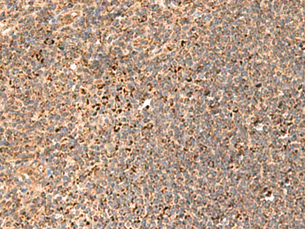 Immunohistochemistry of paraffin-embedded Human tonsil tissue  using REG1B Polyclonal Antibody at dilution of 1:55(×200)