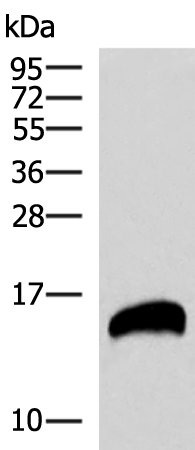 Western blot analysis of Human pancreas tissues lysate  using REG1B Polyclonal Antibody at dilution of 1:800