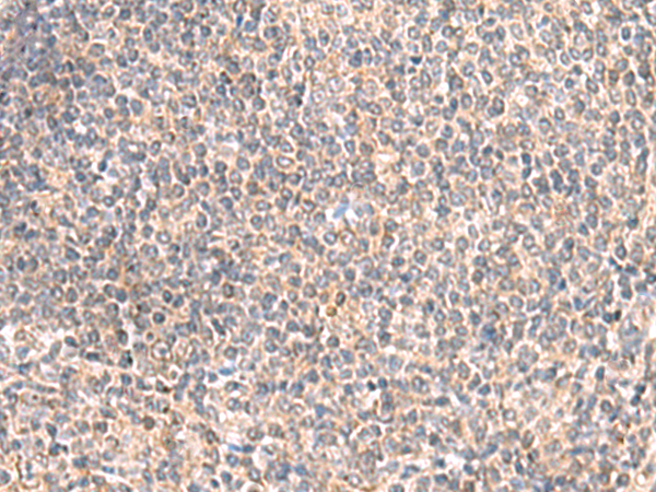 Immunohistochemistry of paraffin-embedded Human tonsil tissue  using GIMAP2 Polyclonal Antibody at dilution of 1:55(×200)