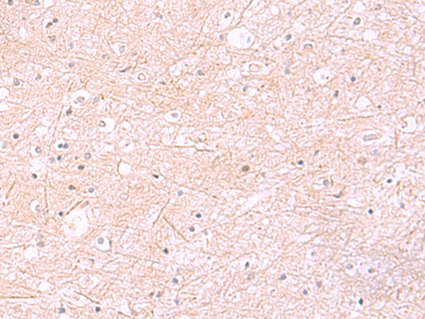 Immunohistochemistry of paraffin-embedded Human brain tissue  using RABEPK Polyclonal Antibody at dilution of 1:85(×200)