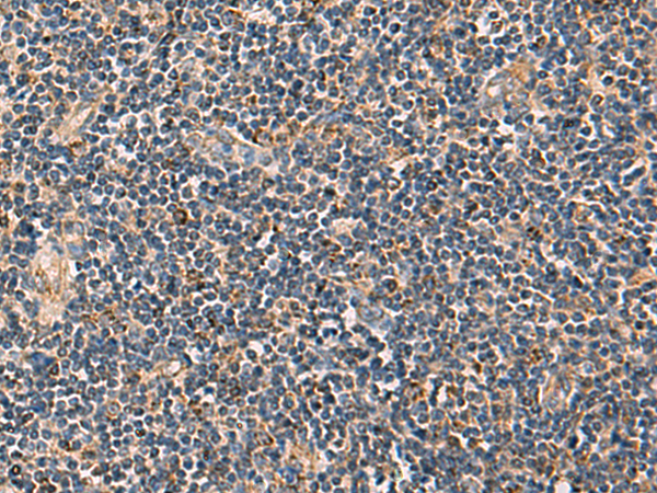 Immunohistochemistry of paraffin-embedded Human tonsil tissue  using PDHA1 Polyclonal Antibody at dilution of 1:50(×200)