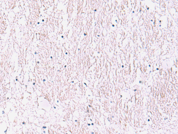 Immunohistochemistry of paraffin-embedded Human brain tissue  using SMPD2 Polyclonal Antibody at dilution of 1:90(×200)