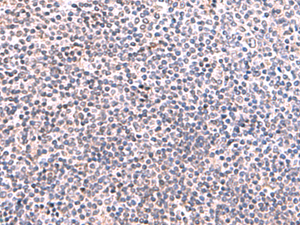 Immunohistochemistry of paraffin-embedded Human tonsil tissue  using KIR3DL1 Polyclonal Antibody at dilution of 1:95(×200)