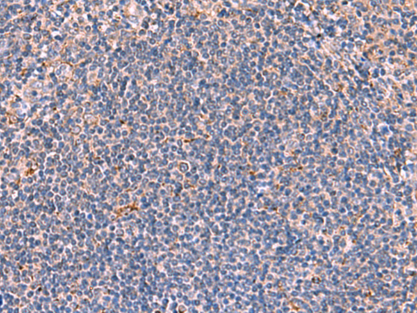 Immunohistochemistry of paraffin-embedded Human tonsil tissue  using FDXR Polyclonal Antibody at dilution of 1:85(×200)