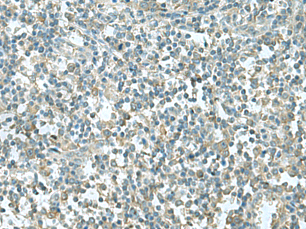 Immunohistochemistry of paraffin-embedded Human tonsil tissue  using CCT5 Polyclonal Antibody at dilution of 1:55(×200)