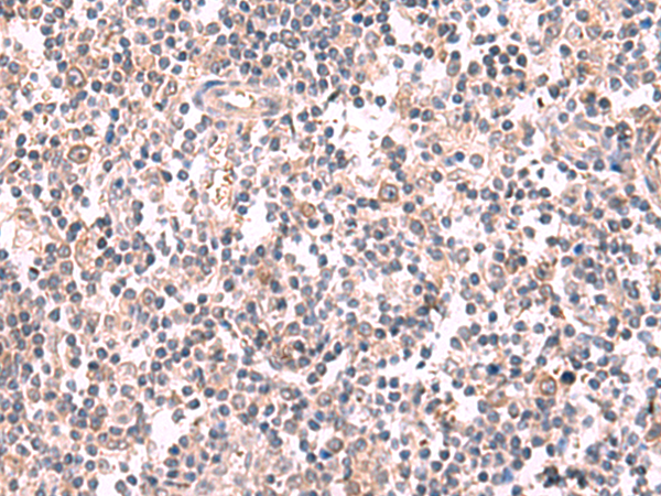 Immunohistochemistry of paraffin-embedded Human tonsil tissue  using GSPT2 Polyclonal Antibody at dilution of 1:50(×200)