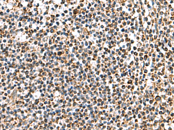 Immunohistochemistry of paraffin-embedded Human tonsil tissue  using AP1S3 Polyclonal Antibody at dilution of 1:70(×200)