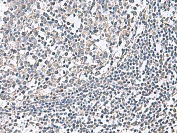 Immunohistochemistry of paraffin-embedded Human tonsil tissue  using NPHP1 Polyclonal Antibody at dilution of 1:75(×200)