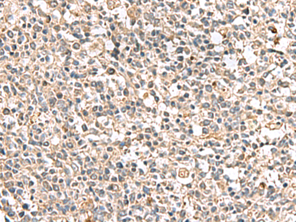 Immunohistochemistry of paraffin-embedded Human tonsil tissue  using PTPRS Polyclonal Antibody at dilution of 1:110(×200)