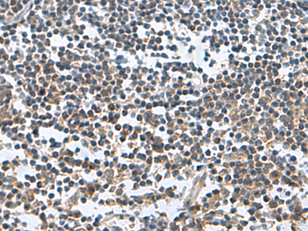 Immunohistochemistry of paraffin-embedded Human tonsil tissue  using FAM107B Polyclonal Antibody at dilution of 1:150(×200)
