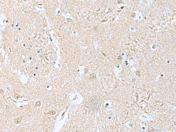 Immunohistochemistry of paraffin-embedded Human brain tissue  using TPD52L3 Polyclonal Antibody at dilution of 1:160(×200)