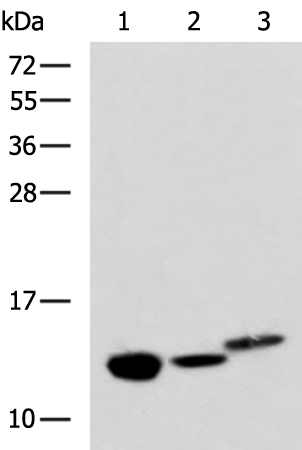 Western blot analysis of Rat kidney tissue Mouse liver tissue and Human fetal liver tissue lysates  using RIDA Polyclonal Antibody at dilution of 1:600