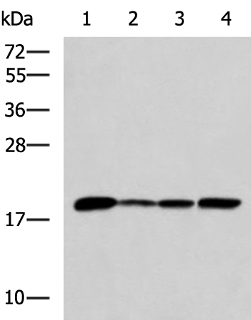 Western blot analysis of K562 Jurkat HepG2 cell Human fetal intestines tissue lysates  using AK6 Polyclonal Antibody at dilution of 1:800
