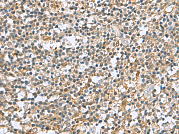 Immunohistochemistry of paraffin-embedded Human tonsil tissue  using DNPH1 Polyclonal Antibody at dilution of 1:60(×200)