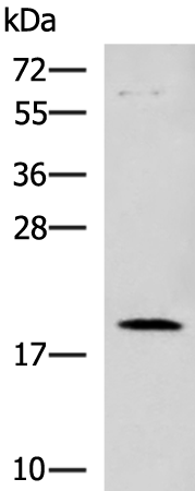 Western blot analysis of Human heart tissue lysate  using DNPH1 Polyclonal Antibody at dilution of 1:800