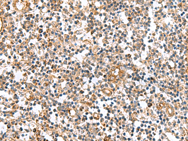Immunohistochemistry of paraffin-embedded Human tonsil tissue  using MRPS28 Polyclonal Antibody at dilution of 1:60(×200)