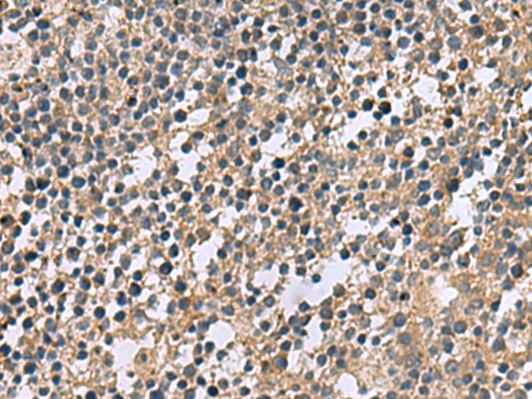 Immunohistochemistry of paraffin-embedded Human tonsil tissue  using CSRP2 Polyclonal Antibody at dilution of 1:60(×200)