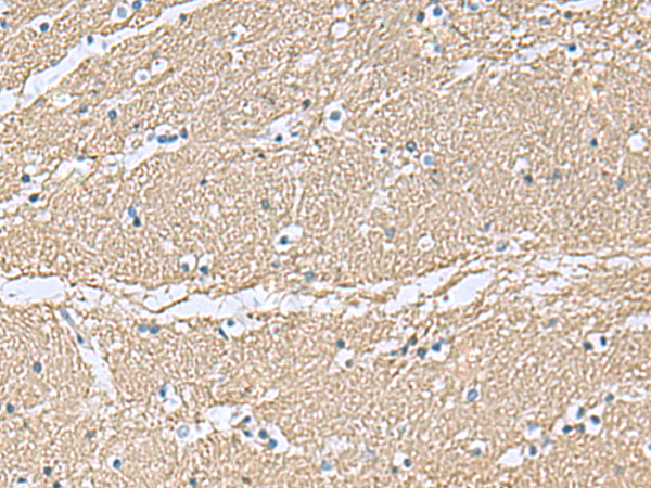 Immunohistochemistry of paraffin-embedded Human brain tissue  using TAGLN3 Polyclonal Antibody at dilution of 1:70(×200)