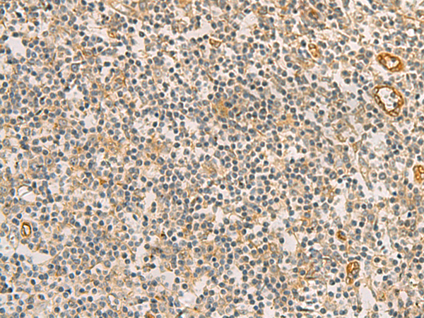 Immunohistochemistry of paraffin-embedded Human tonsil tissue  using RAB13 Polyclonal Antibody at dilution of 1:50(×200)