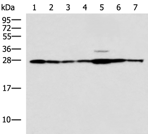 Western blot analysis of Rat liver tissue Mouse kidney tissue Mouse lung tissue HUVEC Jurkat Hela HepG2 cell lysates  using RPL10A Polyclonal Antibody at dilution of 1:700