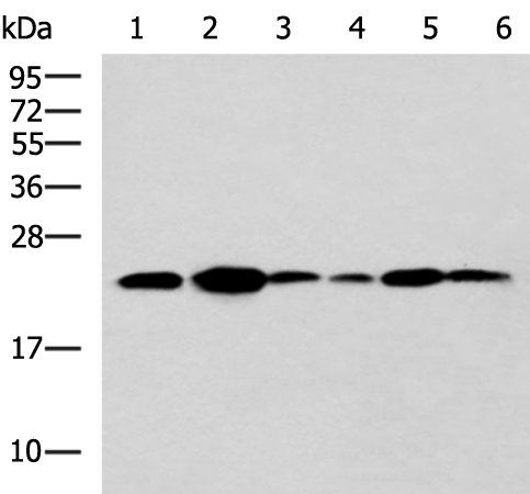Western blot analysis of NIH/3T3 cell Mouse Pancreas tissue Rat lung tissue Mouse liver tissue Hela Raji cell lysates  using TMED10 Polyclonal Antibody at dilution of 1:900