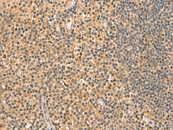 Immunohistochemistry of paraffin-embedded Human tonsil tissue  using UCHL1 Polyclonal Antibody at dilution of 1:60(×200)