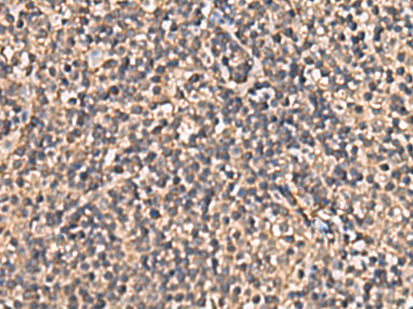 Immunohistochemistry of paraffin-embedded Human tonsil tissue  using PLEKHF2 Polyclonal Antibody at dilution of 1:90(×200)