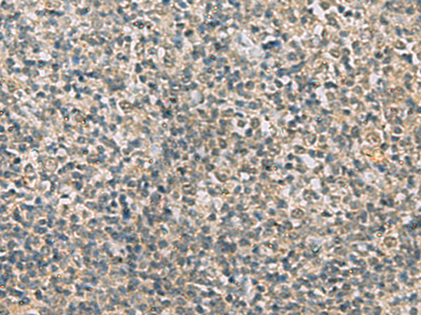 Immunohistochemistry of paraffin-embedded Human tonsil tissue  using RAB3IP Polyclonal Antibody at dilution of 1:60(×200)