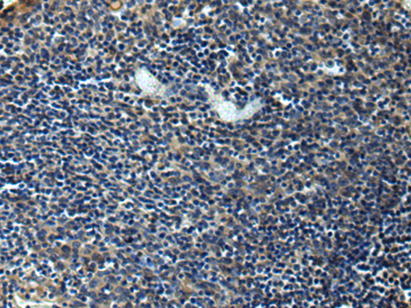 Immunohistochemistry of paraffin-embedded Human tonsil tissue  using ERLIN1 Polyclonal Antibody at dilution of 1:50(×200)