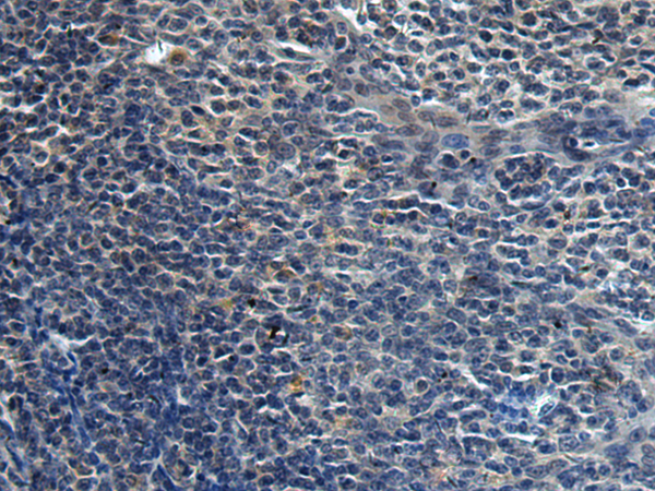 Immunohistochemistry of paraffin-embedded Human tonsil tissue  using HAUS6 Polyclonal Antibody at dilution of 1:45(×200)