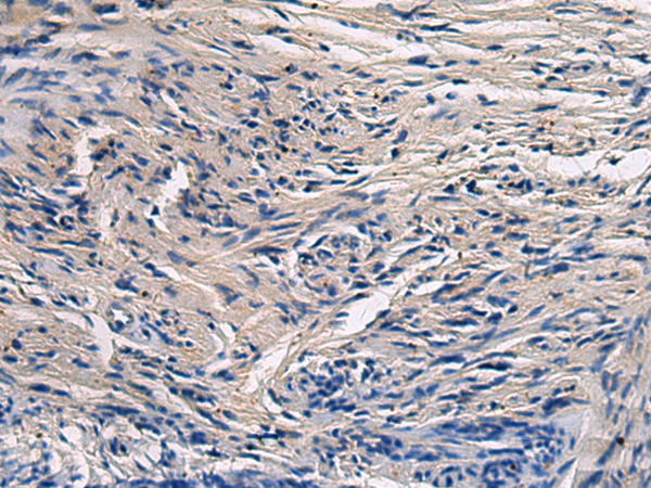 Immunohistochemistry of paraffin-embedded Human brain tissue  using CYTIP Polyclonal Antibody at dilution of 1:50(×200)