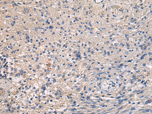 Immunohistochemistry of paraffin-embedded Human brain tissue  using MAPKAPK3 Polyclonal Antibody at dilution of 1:95(×200)