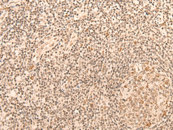 Immunohistochemistry of paraffin-embedded Human tonsil tissue  using CCNE1 Polyclonal Antibody at dilution of 1:25(×200)