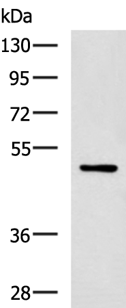 Western blot analysis of MCF-7 cell lysate  using PAX2 Polyclonal Antibody at dilution of 1:400