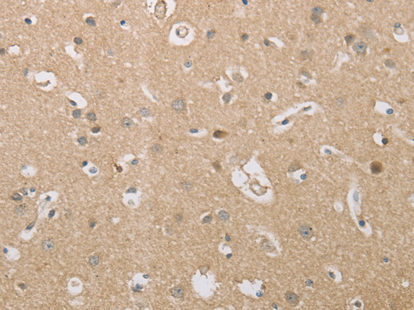 Immunohistochemistry of paraffin-embedded Human brain tissue  using P2RY11 Polyclonal Antibody at dilution of 1:30(×200)