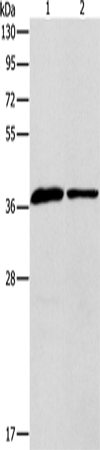 Western blot analysis of Human fetal liver tissue huvec cells  using APOL2 Polyclonal Antibody at dilution of 1:725