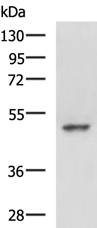 Western blot analysis of Hela cell lysate  using MYCN Polyclonal Antibody at dilution of 1:800