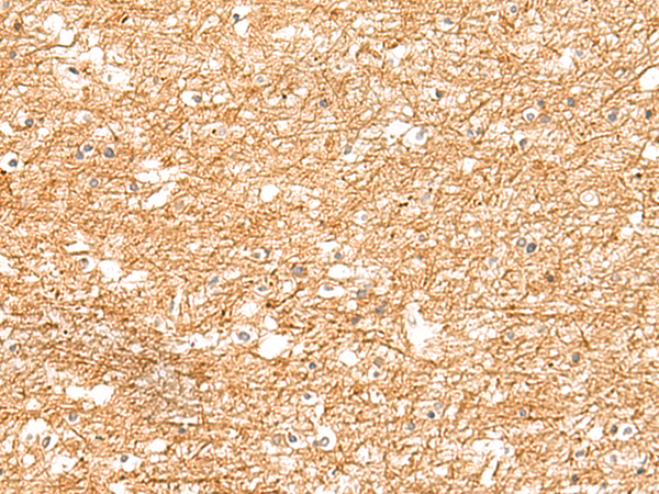 Immunohistochemistry of paraffin-embedded Human brain tissue  using ZNF185 Polyclonal Antibody at dilution of 1:25(×200)