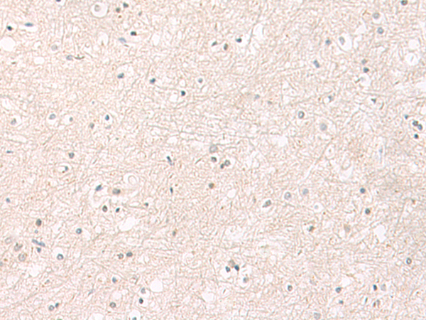 Immunohistochemistry of paraffin-embedded Human brain tissue  using FGFR4 Polyclonal Antibody at dilution of 1:25(×200)