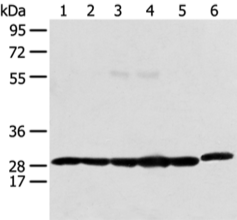 Western blot analysis of 293T Raji and Hela cell  using PRDX4 Polyclonal Antibody at dilution of 1:400