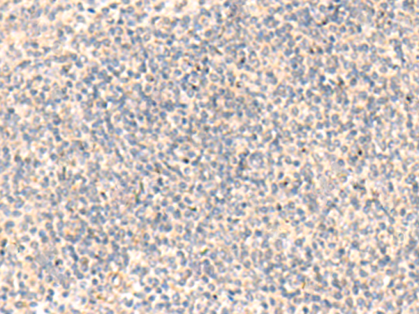 Immunohistochemistry of paraffin-embedded Human tonsil tissue  using ADAMTS2 Polyclonal Antibody at dilution of 1:45(×200)