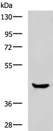 Western blot analysis of Human muscle tissue lysate  using HOXA2 Polyclonal Antibody at dilution of 1:800