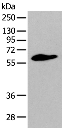 Western blot analysis of Human prostate tissue  using STEAP2 Polyclonal Antibody at dilution of 1:400