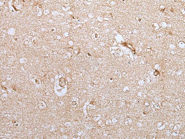 Immunohistochemistry of paraffin-embedded Human brain tissue  using HOXC9 Polyclonal Antibody at dilution of 1:35(×200)