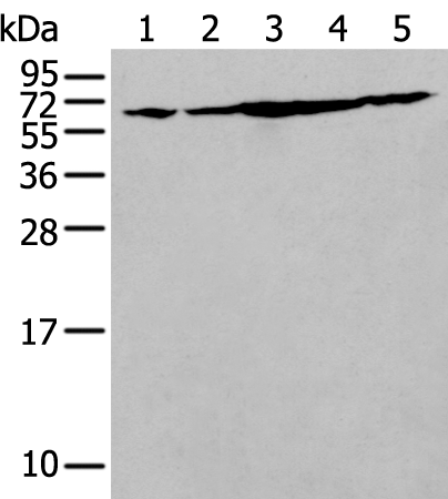 Western blot analysis of NIH/3T3 Hela Jurkat Hepg2 and A549 cell lysates  using IRF5 Polyclonal Antibody at dilution of 1:250