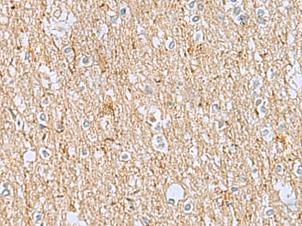 Immunohistochemistry of paraffin-embedded Human brain tissue  using LRRC49 Polyclonal Antibody at dilution of 1:40(×200)