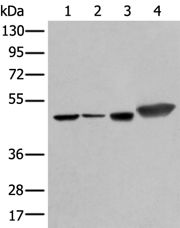 Western blot analysis of Hepg2 A431 Hela and A549 cell lysates  using PLAG1 Polyclonal Antibody at dilution of 1:250