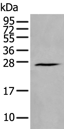 Western blot analysis of Human fetal brain tissue lysate  using HAND1 Polyclonal Antibody at dilution of 1:400