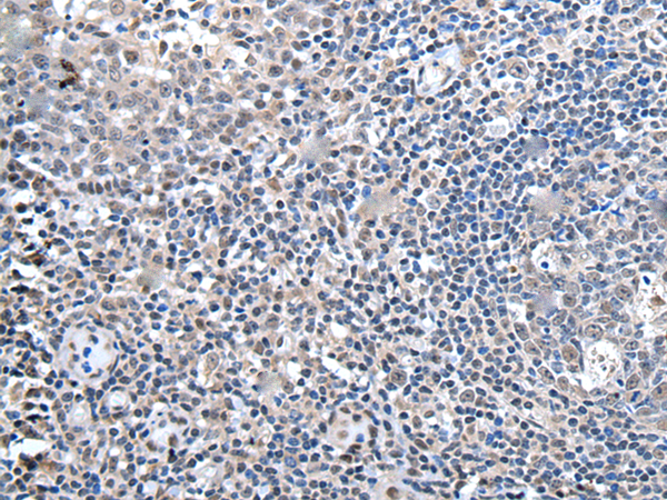 Immunohistochemistry of paraffin-embedded Human tonsil tissue  using ZBTB10 Polyclonal Antibody at dilution of 1:100(×200)