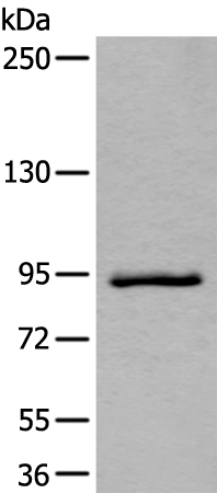 Western blot analysis of Jurkat cell lysate  using ZBTB10 Polyclonal Antibody at dilution of 1:800